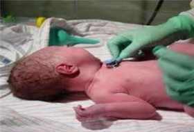 تولد نوزادان سه قلو پس از ۲۷ سال انتظار در کرمان