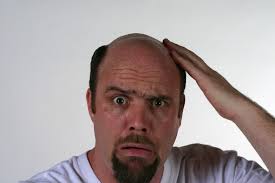 علت اصلی ریزش موی مردان چیست؟