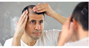 واقعیت هایی در مورد ریزش مو: ۸ باور اشتباه که باید فراموش کنید