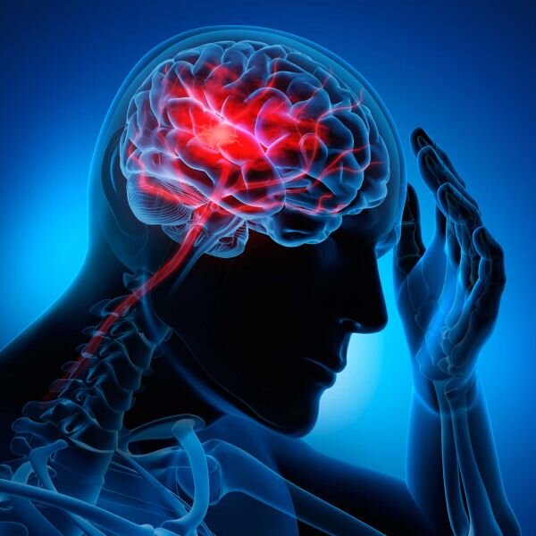 چه درمان هایی برای سکته مغزی مناسب هستند؟